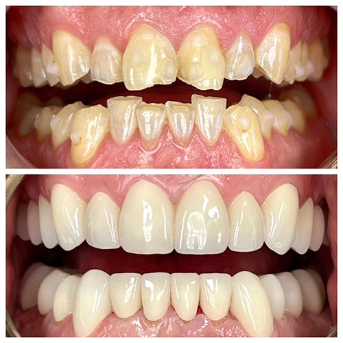 Before and After example August 2026